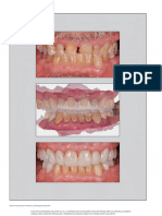 Revista Internacional de Periodoncia y Odontología Restauradora