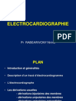 ECG