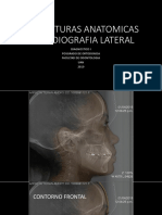 Estructuras radiográficas lateral cefalométricas