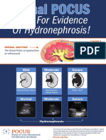 Look For Evidence of Hydronephrosis!: Mild Moderate Severe