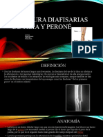 Fracturas diafisarias tibia y peroné