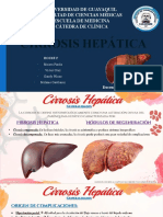 Cirrosis Hepática - House F