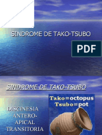 Sindrome de Tako-Tsubo