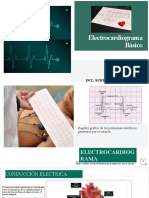 Electrocardiograma Normal