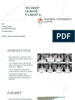 Lung Disease Detection Using Deep Learning After Bone Suppression in Chest X-Rays