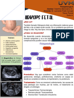 Infografía. Hidrops Fetal