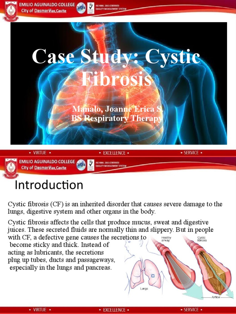 case study cystic fibrosis quizlet