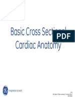 Basic Cross Sectional Cardiac Anatomy