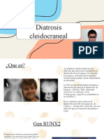 Diatrosis Cleidocraneal