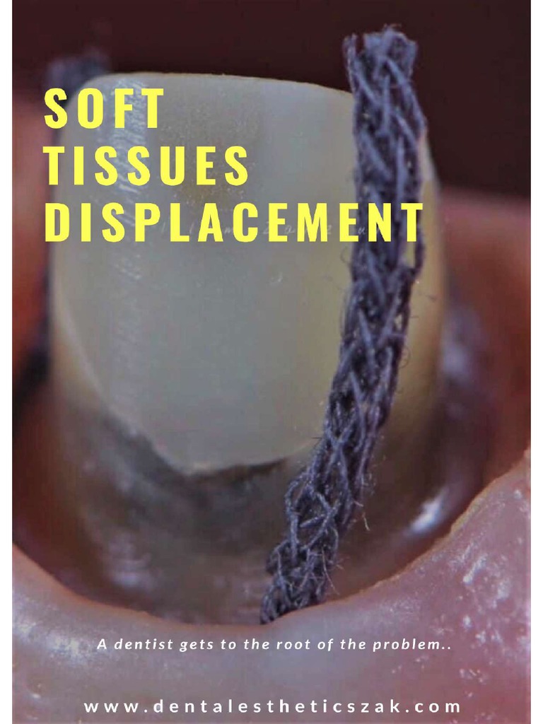 Soft Tissues Displacement | PDF | Periodontology