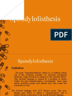Spondylolisthesis  