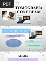 Tomografía Cone Beam en Odontología | PDF | Ct Scan | Física Médica