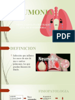 Neumonia