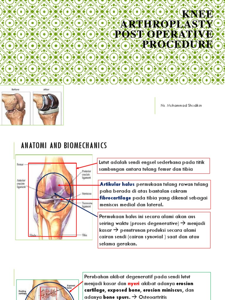 Knee Arthroplasty Post Operation Procedure PDF