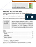 Bonding To Caries-Affected Dentin: Masatoshi Nakajima, Sitthikorn Kunawarote, Taweesak Prasansuttiporn, Junji Tagami