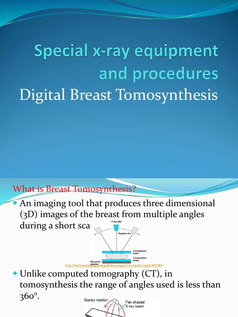 Digital Breast Tomosynthesis | PDF | Ct Scan | Medical Imaging