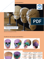 Skull Anatomy and Esthetics