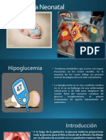 Hipoglucemia Neonatal