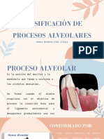 Clasificación de Procesos Alveolares