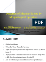 Detection of Macular Edema by Morphological Operation.: B. Ramasubramanian