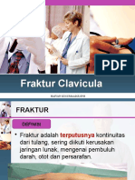 Fraktur Clavicula