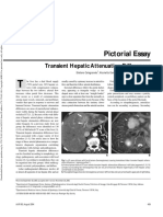 Transient Hepatic Attenuation Differences