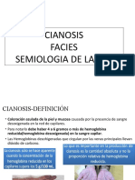 Cianosis Facial - Tos X
