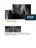 Radiografia h4