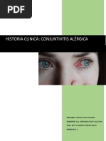Historia Clinica (Conjuntivitis Alérgica)