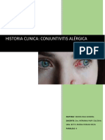 Historia Clinica (Conjuntivitis Alérgica)