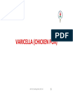 Varicella (Chicken Pox) : IAP UG Teaching Slides 2015 16