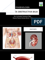 Uropatía Obstructiva Baja