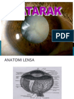 Katarak: Anatomi, Etiologi, Diagnosa dan Perawatan