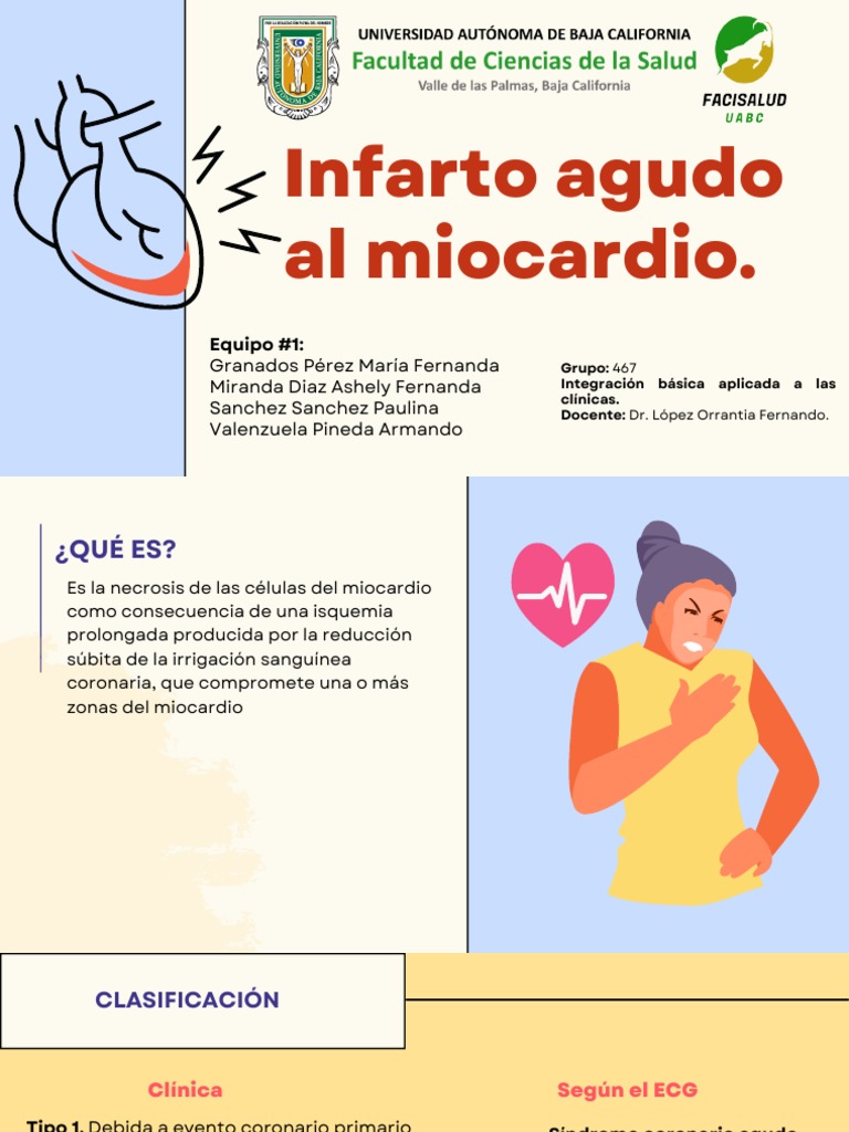 Infarto Agudo Al Miocardio.: Equipo #1 | PDF | Infarto de miocardio ...