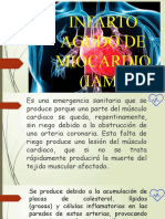 Infarto agudo de miocardio: causas, síntomas y tratamiento