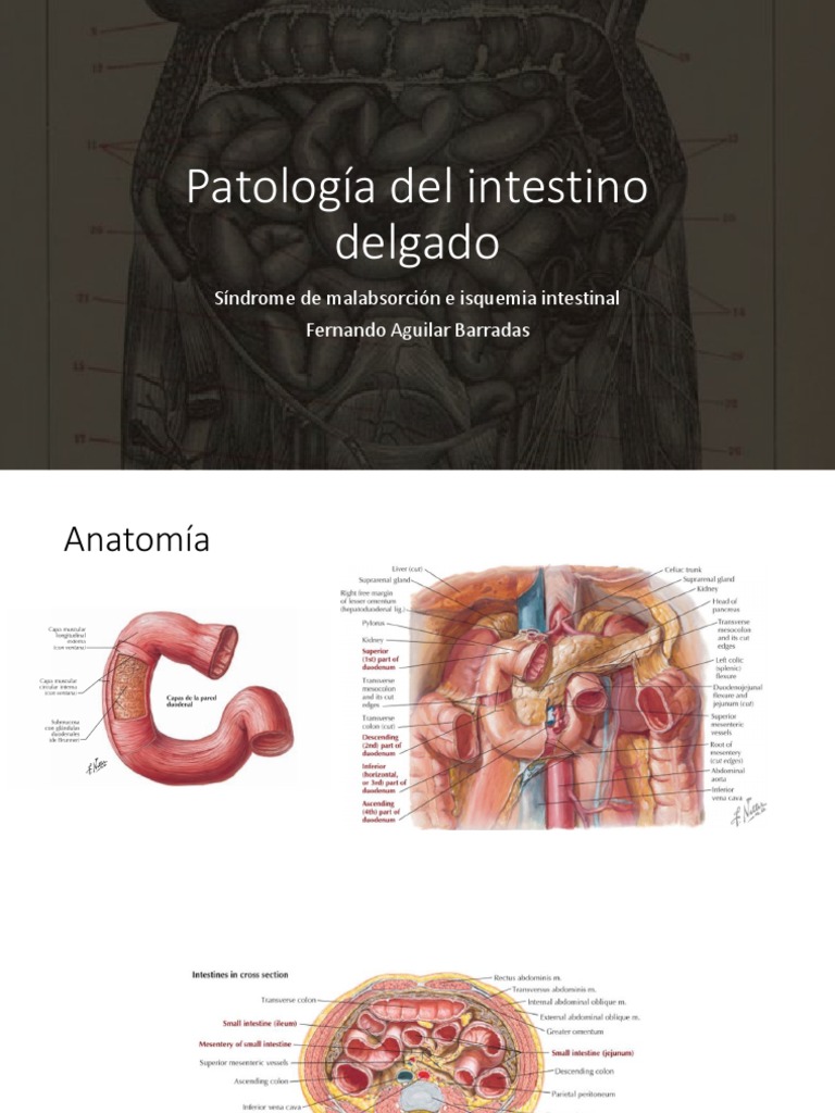 Malabsorción y patologías del intestino delgado | PDF | Enfermedad ...