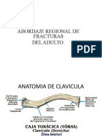 Tema 6 Fractura de Clavicula