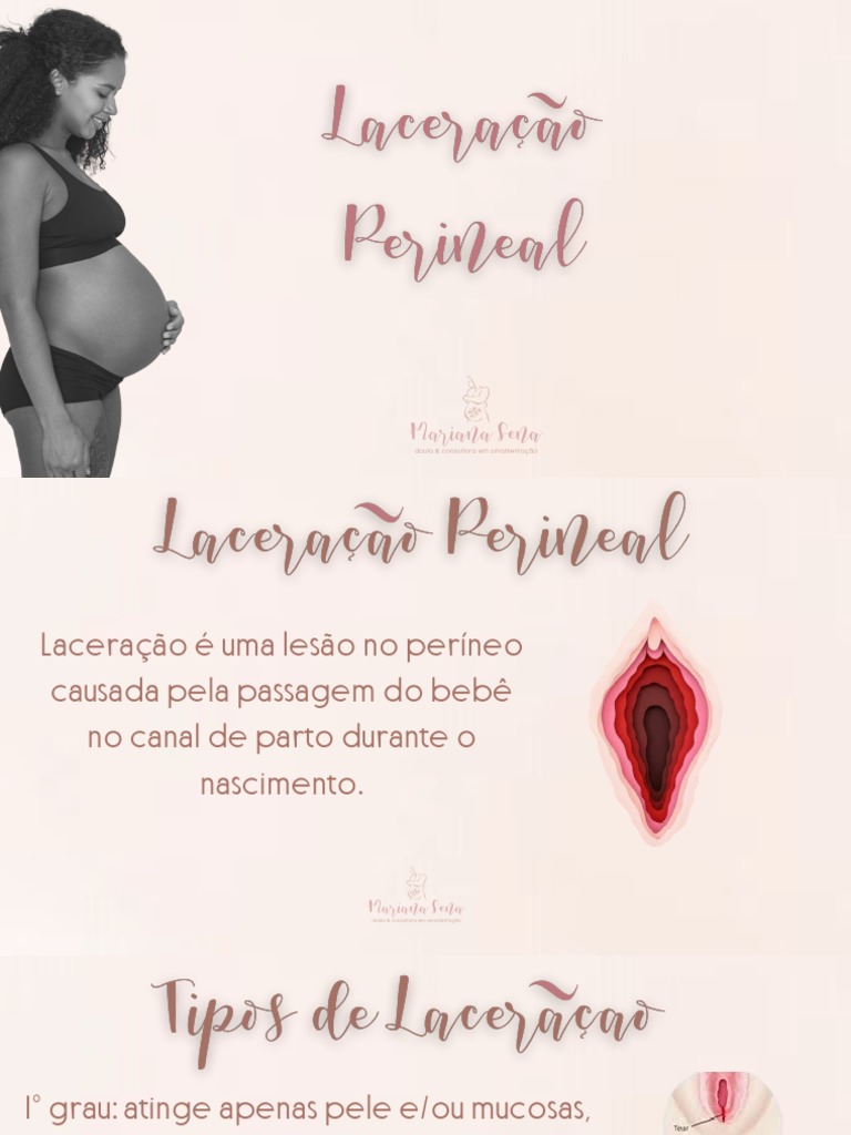 Graus de Laceração Perineal no Parto Normal | PDF | Parto | Gravidez