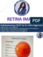 Ophthalmology NEXT by Dr. Niha Aggarwal: Telegram: Https://t.me/nihaophtha