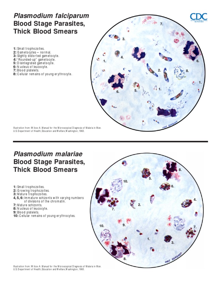 Blood Stage Morphology of Plasmodium | PDF