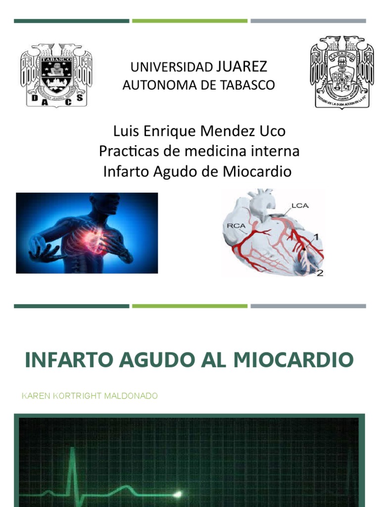 Electrocardiograma en Infarto Agudo | PDF | Infarto de miocardio ...
