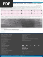 A 54-Year-Old Man With An NSTEMI and Upcoming Non-Cardiac Surgery - American College of Cardiology