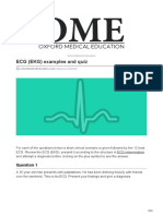 ECG (EKG) Examples and Quiz: Oxford Medical Education