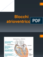 Blocchi Atrioventricolari BAV