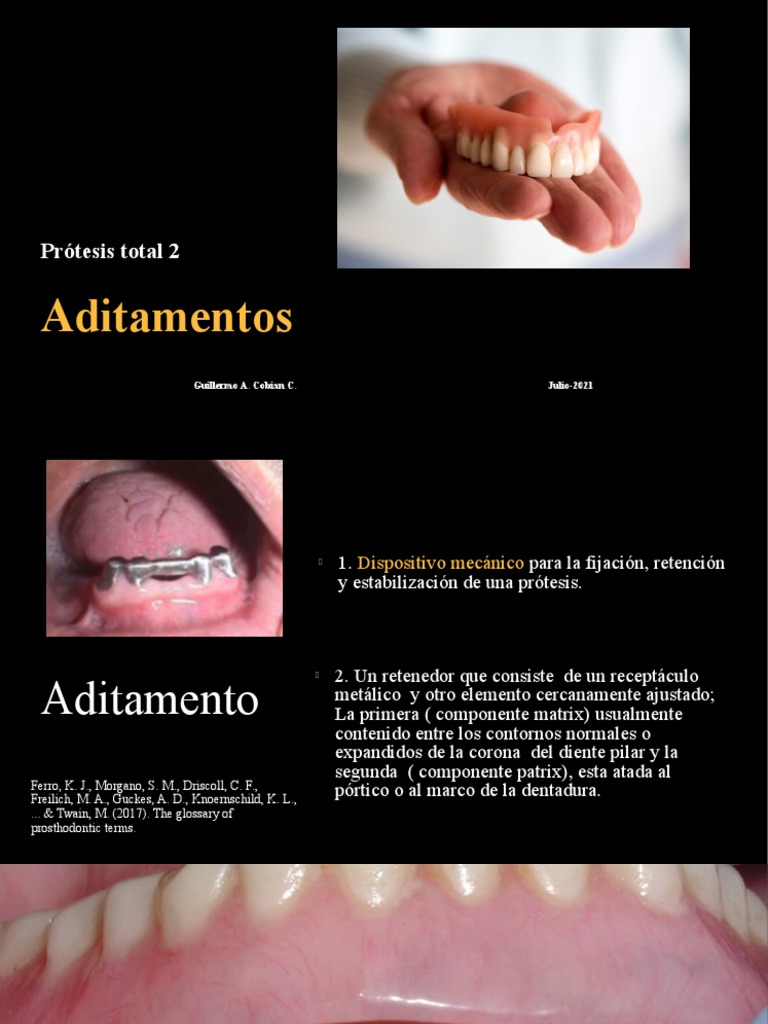 Aditamentos de Sobredentaduras | PDF | Dentadura postiza | Ramas de ...