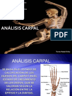 Analis Carpal