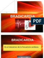 Bradicardia