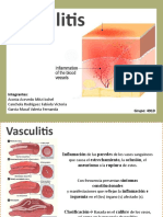 Vasculitis FVCR