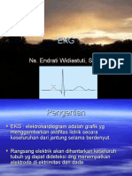 EKG Terkn