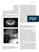 A Rare Mimic of Colon Cancer Ameboma 627.627